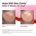 Anua - Niacinamide 10 + TXA 4 Serum (Original)