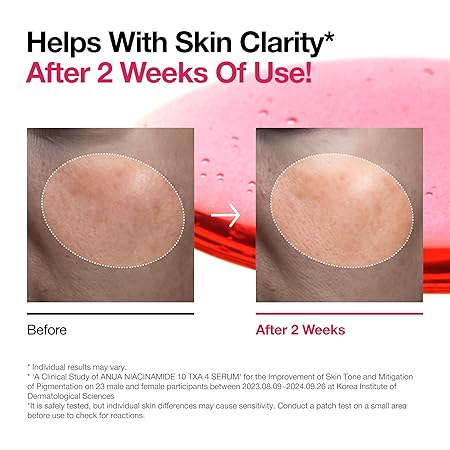 Anua - Niacinamide 10 + TXA 4 Serum (Original)